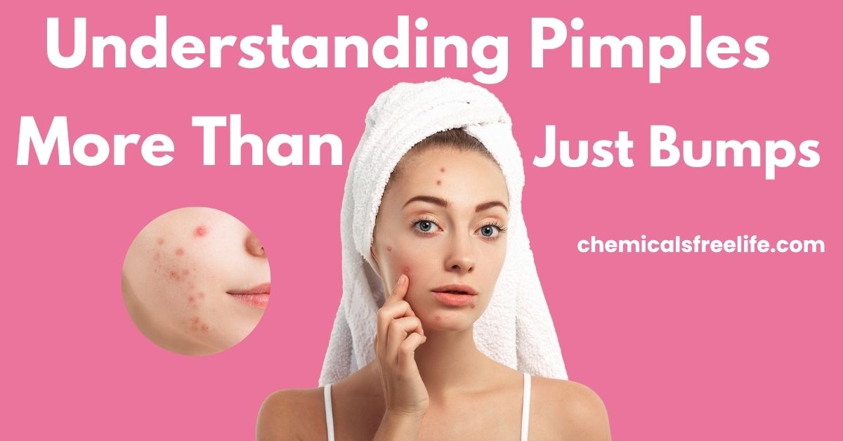 Understanding Pimples: More Than Just Bumps